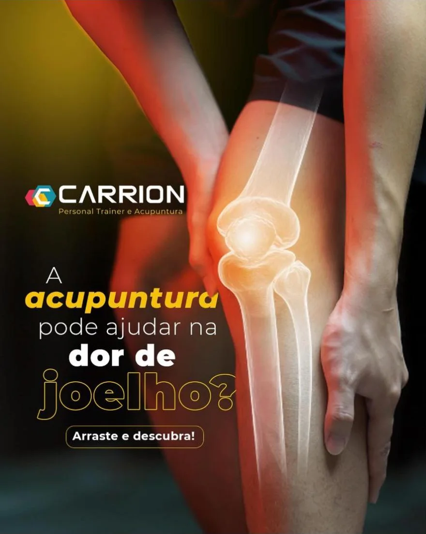 Post do Carrion sobre acupuntura para dor no joelho, com o logo hexagonal
